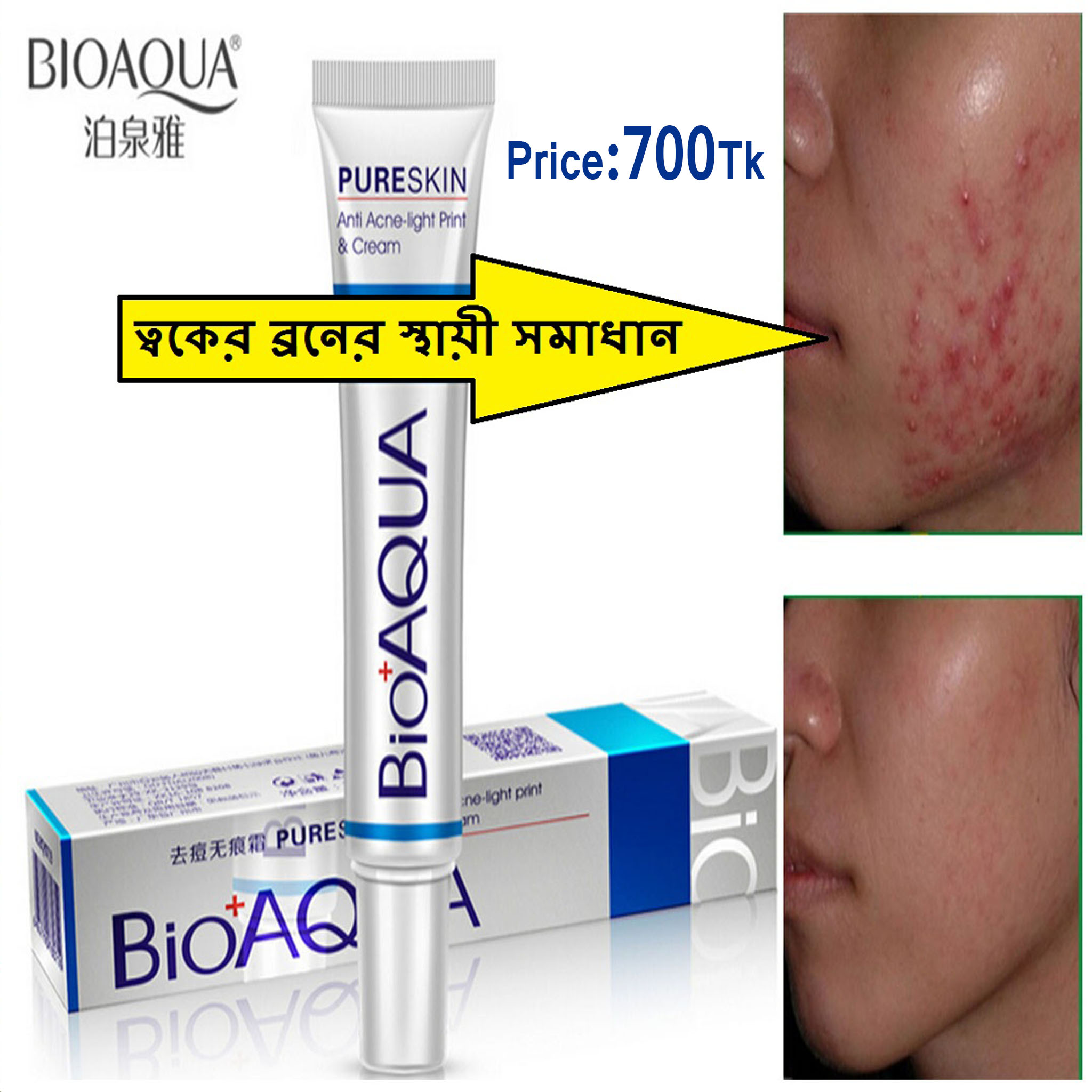 BioAQUA Anti Acne Light Print & Cream